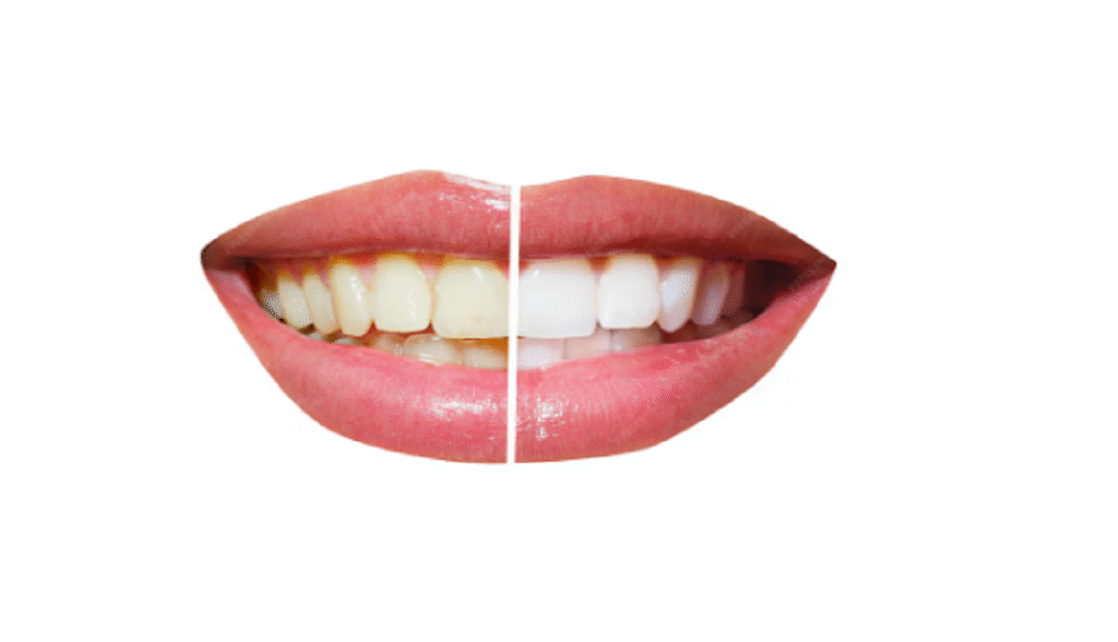 Teeth Cleaning vs. Whitening.jpg