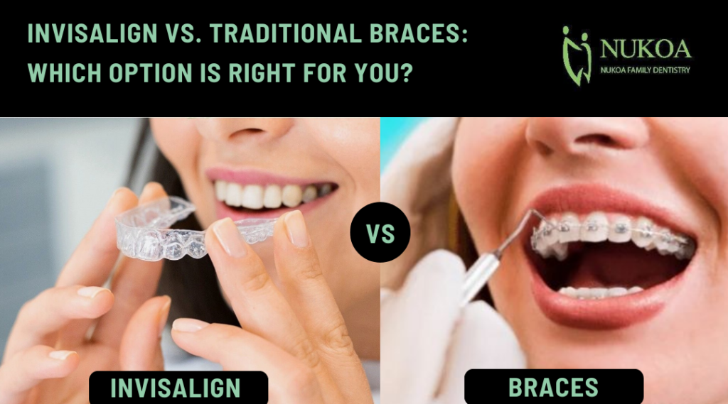 Invisalign vs. Traditional Braces Which Option is Right for You
