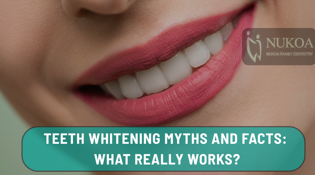Teeth Whitening Myths and Facts